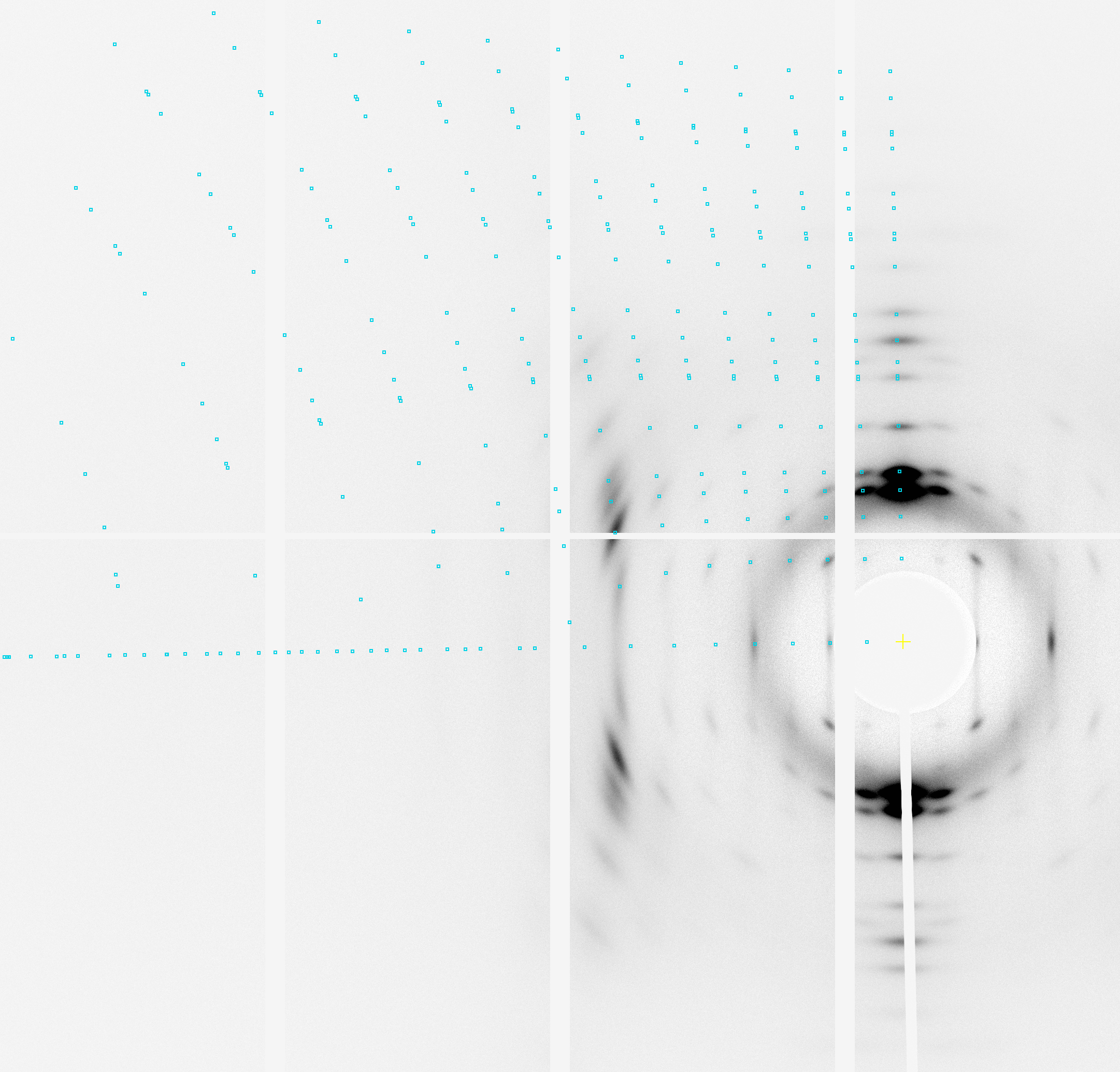 PCL 指标化结果案例图